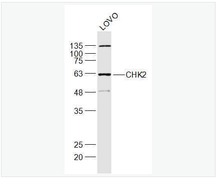 Anti-CHEK2 antibody-细胞周期检测点激酶2抗体