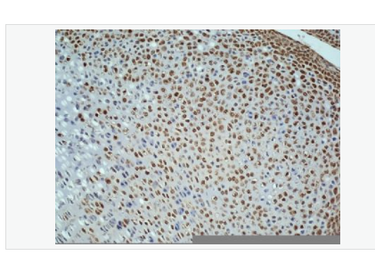 Anti-Ki-67 antibody -Ki67蛋白抗体