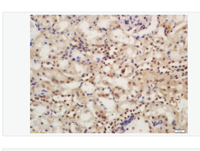 Anti-Phospho-IRAK1 (Ser376) antibody-磷酸化白介素-1受体相关激酶1抗体