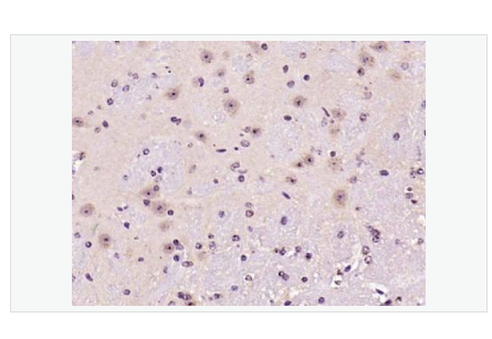 Anti-Ferritin Heavy Chain/FTH1  antibody -铁蛋白抗体