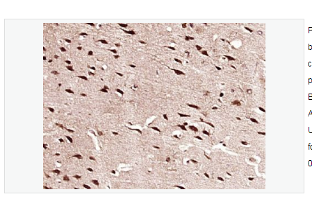 Anti-HES1  antibody -转录因子HES-1抗体