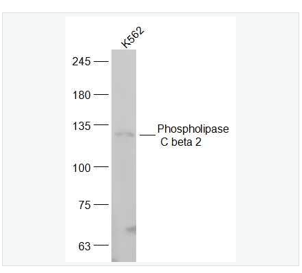 Anti-Phospholipase C beta 2  antibody -磷酯酶Cβ2抗体