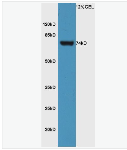 Anti-FZD3 antibody-卷曲蛋白3抗体