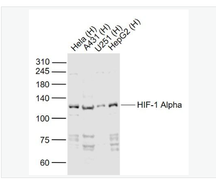 Anti-HIF-1 Alpha antibod-缺氧诱导因子1α /HIF-1α抗体