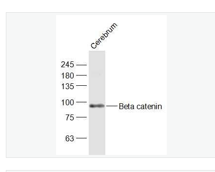 Anti-Beta catenin antibody-β-连环蛋白/β-连环素/β链接素抗体