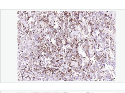 Anti-IRF5 antibody-干扰素调节因子5重组兔单克隆抗体