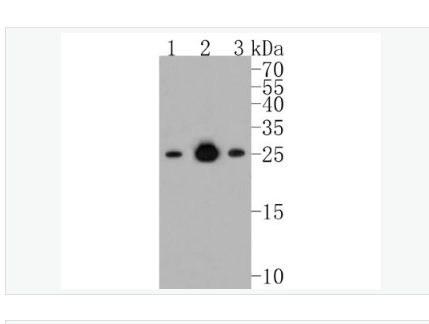 Anti-Bcl-2 antibody-Bcl-2重组兔单克隆抗体