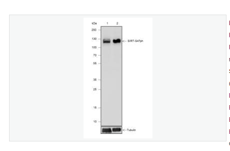 Anti-Phospho-SIRT1  antibody-磷酸化沉默调节蛋白1重组兔单克隆抗体