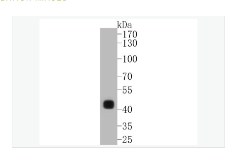 Anti-CDX2  antibody-尾型同源盒转录因子2重组兔单克隆抗体