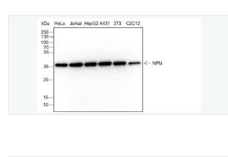 Anti-Nucleophosmin antibody-核仁磷酸蛋白重组兔单克隆抗体