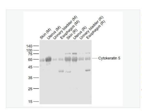 Anti-Cytokeratin 5  antibody-细胞角蛋白5抗体