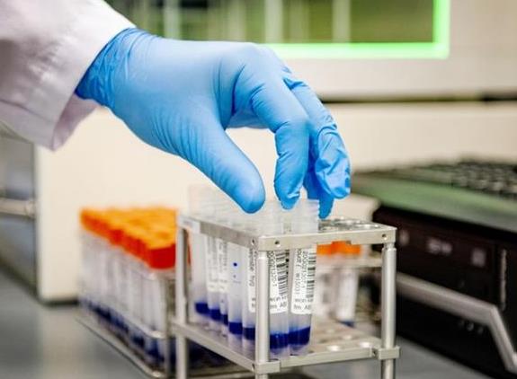 细胞爬片/细胞涂片/细胞滴片服务-艾普蒂生物