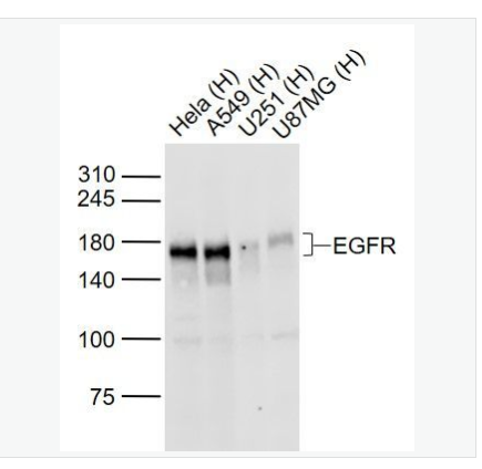 Anti-EGFR antibody-表皮生长因子受体抗体