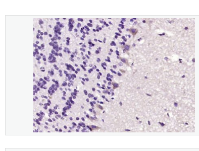 Anti-ERK1 antibody-丝裂原活化蛋白激酶1抗体