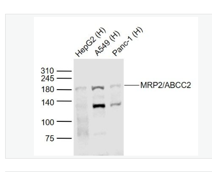 Anti-MRP2/ABCC2 antibody-多药耐药相关蛋白2抗体