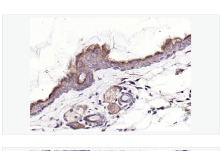 Anti-Neurotrophin 3 antibody-神经营养因子-3前蛋白抗体