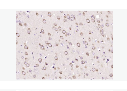 Anti-Semaphorin 3F antibody-臂板蛋白3F抗体