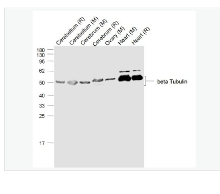 Anti-beta Tubulin (Loading Control) antibody-微管蛋白抗体