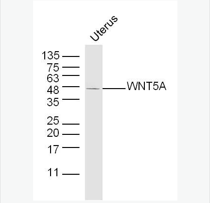 Anti-WNT5A antibody-信号通路Wnt5a抗体