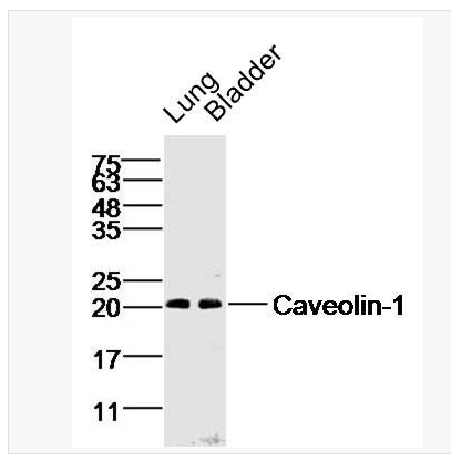 Anti-Caveolin-1 antibody-细胞质膜微囊蛋白-1抗体