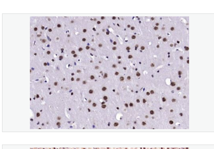 Anti-Notch3 antibody-跨膜受体蛋白Notch-3抗体