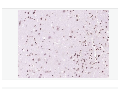 Anti-Phospho-BTK (Tyr223) antibody-磷酸化酪氨酸蛋白激酶BTK抗体