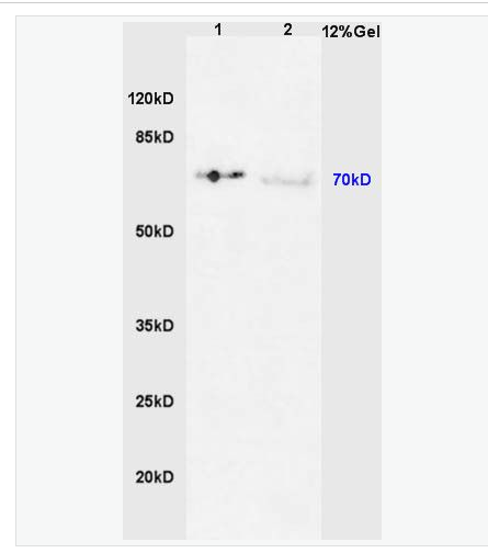 Anti-Phospho-IRAK1 (Thr387) antibody-磷酸化白介素-1受体相关激酶1抗体