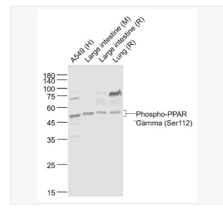 Anti-Phospho-PPAR Gamma (Ser112) antibody-磷酸化过氧化酶活化增生受体γ抗体