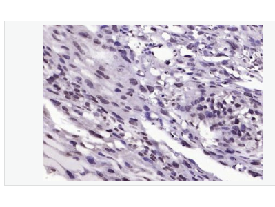 Anti-phospho-B-Raf (Ser602) antibody-磷酸化B-Raf抗体