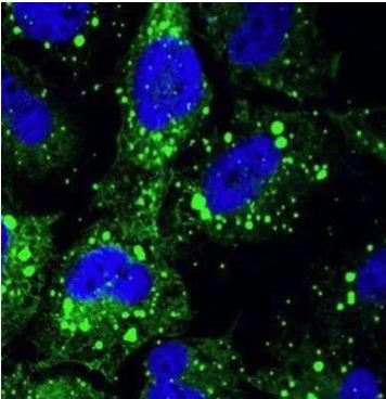 细胞自噬MDC单独染色-艾普蒂生物