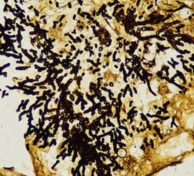 基底膜六胺银染色（PASM）-艾普蒂生物