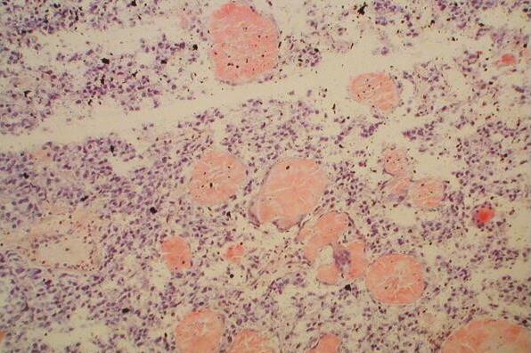 刚果红染色服务-艾普蒂生物