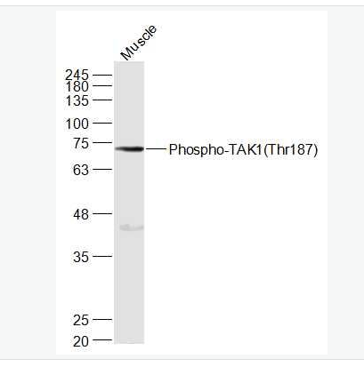 Anti-Phospho-TAK1 (Thr187) antibody-磷酸化转化生长因子β活化激酶1