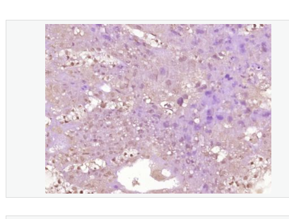 Anti-phospho-KLF5 (Ser311) antibody-磷酸化肠道内富含的Kruppel样因子5抗体