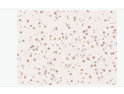 Anti-Phospho-mTOR (Ser2448) antibody-磷酸化雷帕霉素靶蛋白抗体