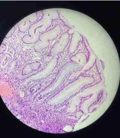 AB-PAS染色（阿利新蓝-过碘酸-雪夫染色）服务-艾普蒂生物