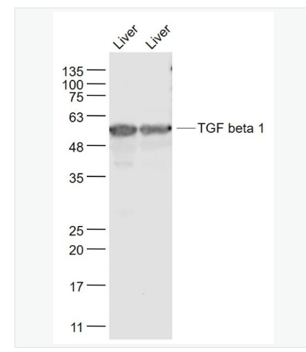 Anti-TGF beta 1 antibody-转化生长因子β1/TGF β1/TGF-β1抗体