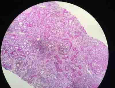 PAS染色（过碘酸雪夫染色）服务-艾普蒂生物