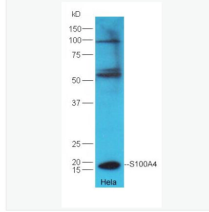 Anti-S100A4 antibody-FSP-1抗体