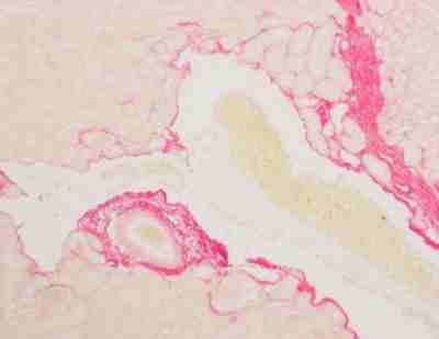 天狼猩红染色服务-艾普蒂生物