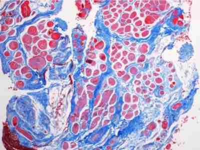 Masson 染色-艾普蒂生物