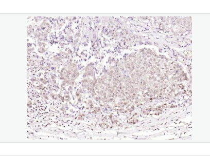 Anti-phospho-BRAF (Thr401) antibody-磷酸化B-Raf抗体