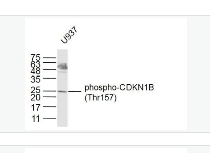 Anti-phospho-CDKN1B (Thr157) antibody-磷酸化P27抗体/周期素依赖激酶抑制剂抗体