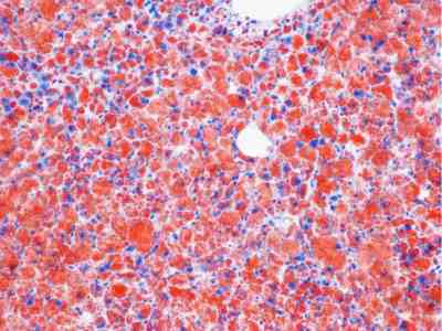 组织石蜡包埋服务-艾普蒂生物