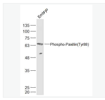 Anti-Phospho-Paxillin (Tyr88) antibody-磷酸化桩蛋白Paxillin抗体