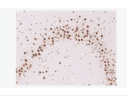 Anti-KLHL7 antibody-kelch样蛋白7抗体