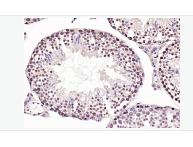 Anti-RNA polymerase II antibody-RNA聚合酶II抗体