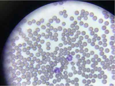 外周血单核细胞PBMC分离技术服务-艾普蒂生物