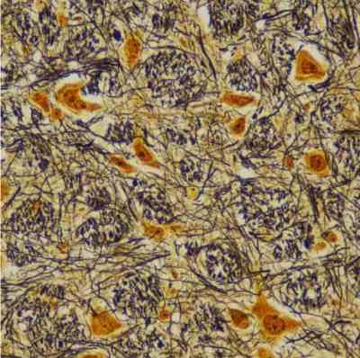 Transwell迁移技术服务-艾普蒂生物