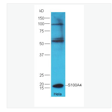 Anti-S100A4  antibody-FSP-1抗体